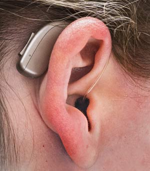 Hearing 360 Degree clinic — hearing aid fitting by RCI-registered audiologist in Garia, Kolkata